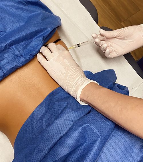 mesoterapia corporal grasa localizada clinica tufet barcelona