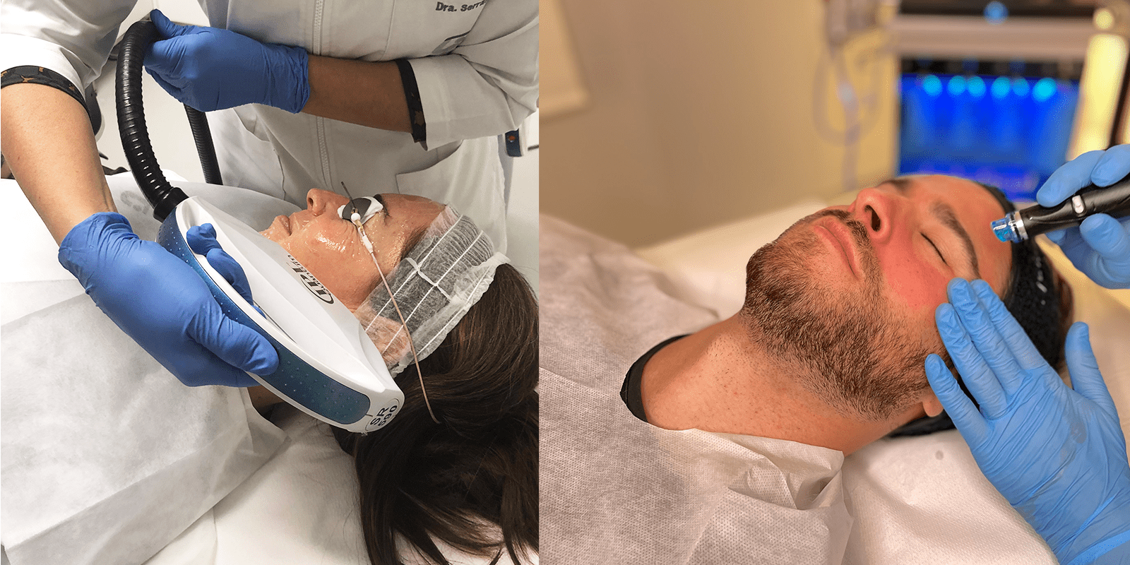 ipl luz pulsada intensa clinica tufet