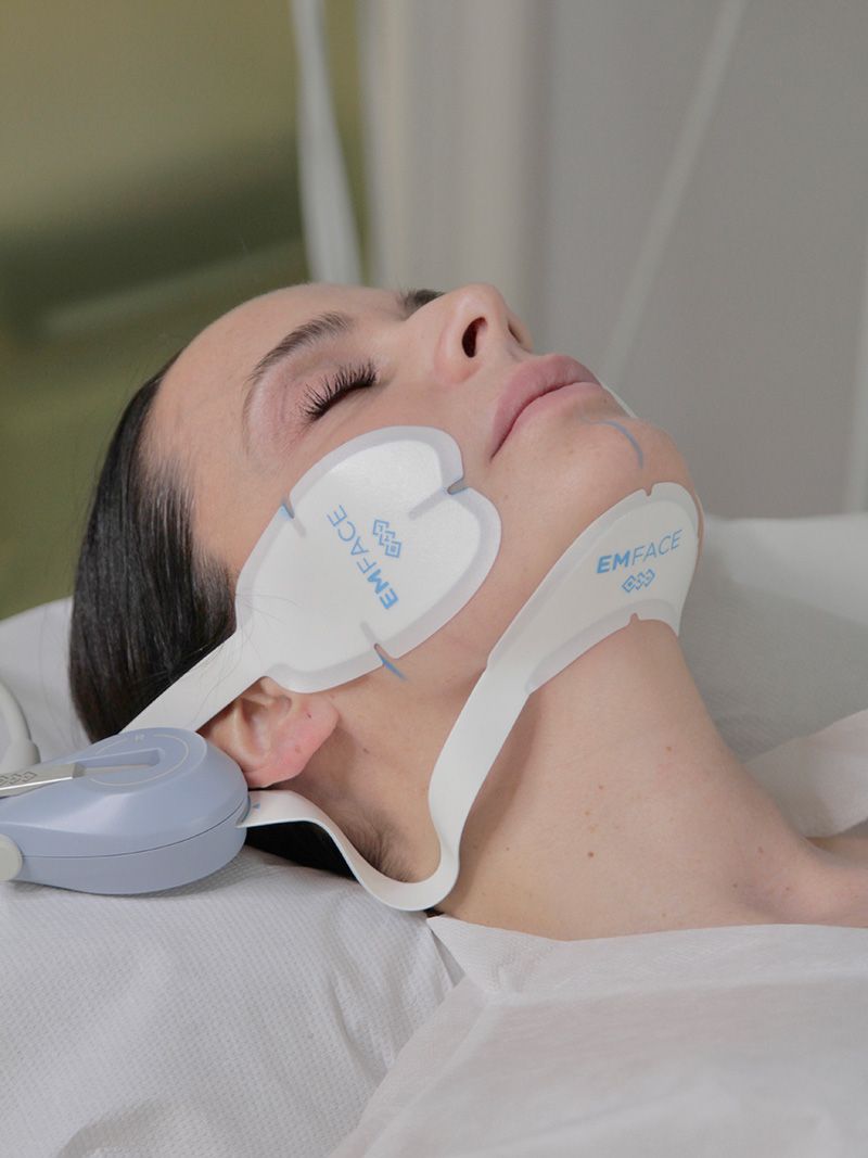 flacidez facial emface