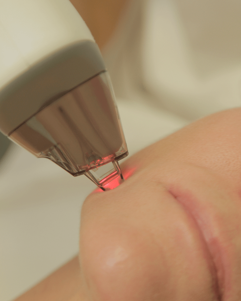 tratar textura de la piel